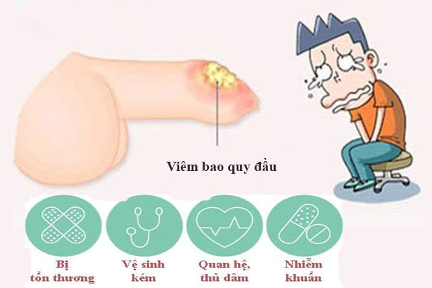 tat-ca-moi-thu-ban-nen-biet-ve-hep-bao-quy-dau