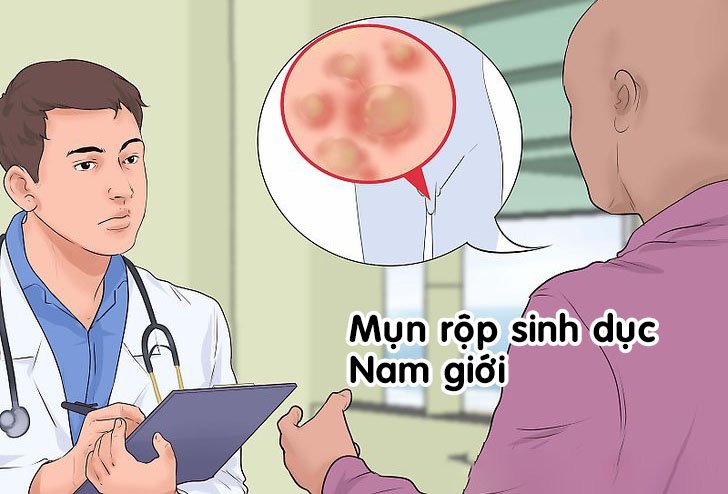 mun-rop-sinh-duc-vi-sao-hay-tai-phat